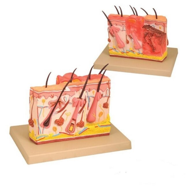 Terve inimese naha plokkmudel põletustega